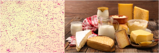 Brucella in dairy products Tunisia dairynews7x7